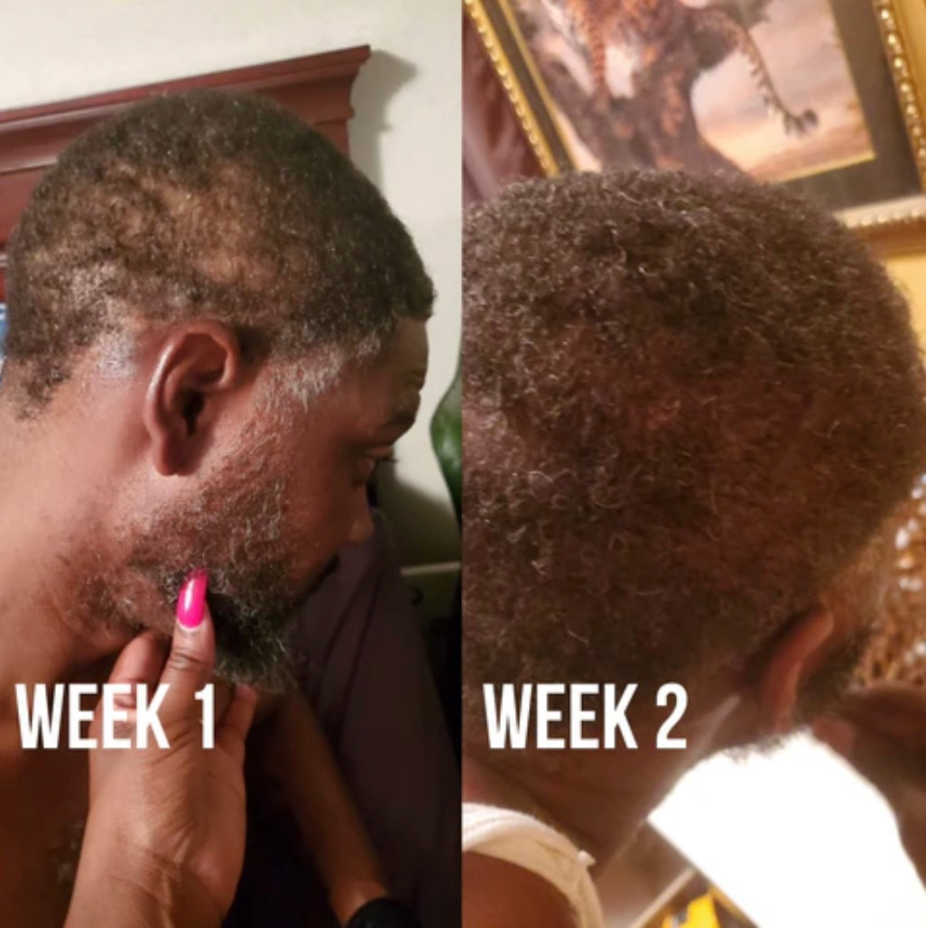 Growth Oil